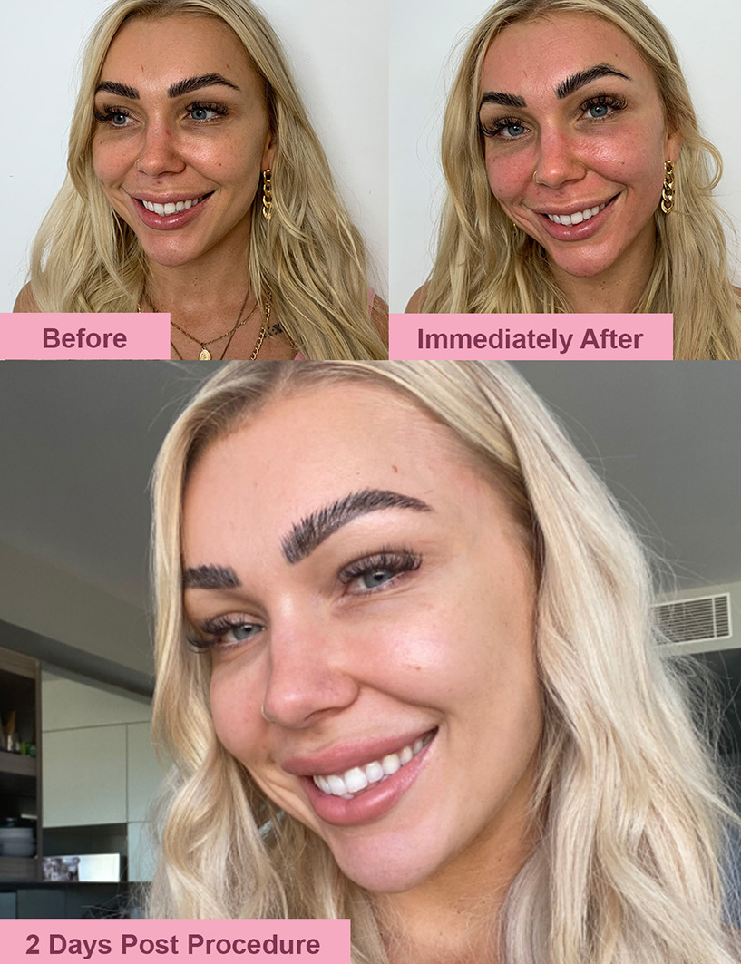 The pink before after