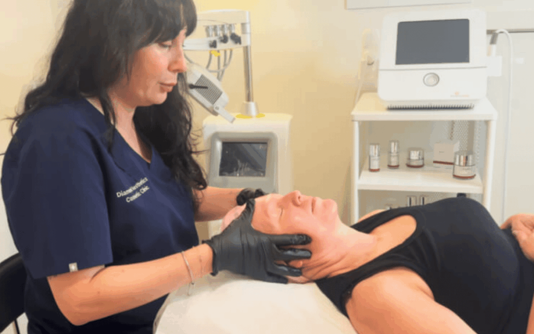 Chemical Peel Treatment in Sydney, Australia