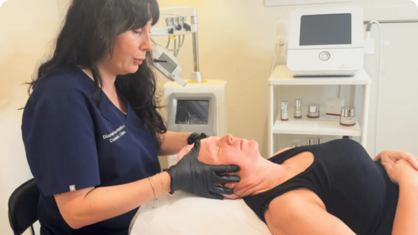 Chemical Peel Treatment in Sydney, Australia